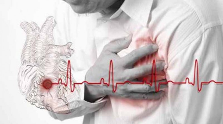 Oι καρδιαγγειακές παθήσεις σκοτώνουν 10.000 ανθρώπους την ημέρα στην Ευρώπη