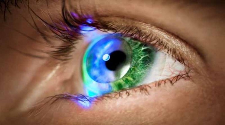 Μυωπία: Καλύτερη η διόρθωση με LASIK από τους φακούς επαφής