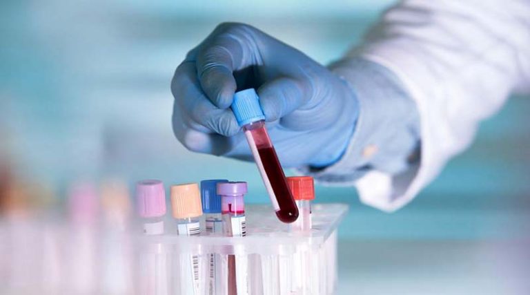 Τεστ αίματος ανιχνεύει 50 τύπους καρκίνου – Τι έδειξε η δοκιμή του